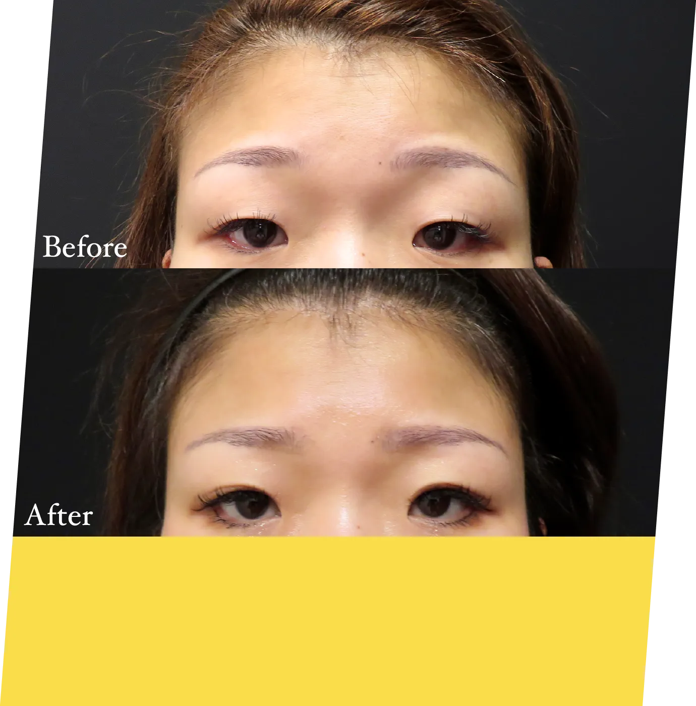 after