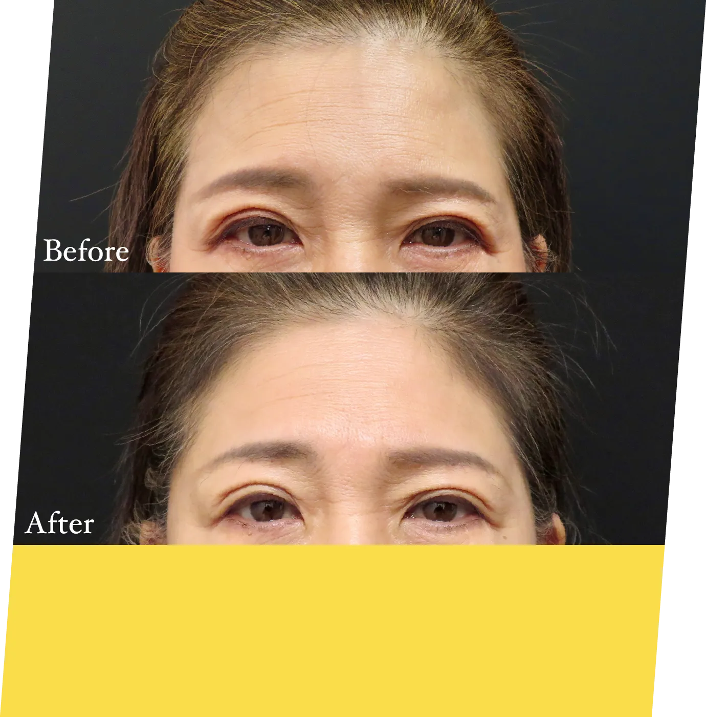after