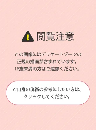 閲覧注意