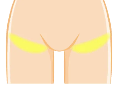 足のつけ根