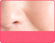 ほうれい線