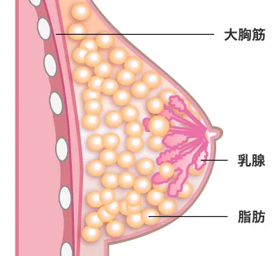 PRP注射