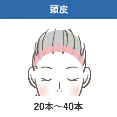 頭皮