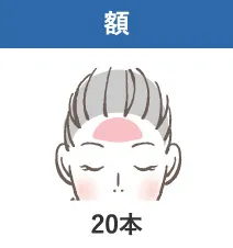額