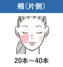 頬(片側)