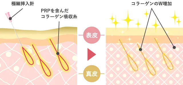 Wコラーゲン