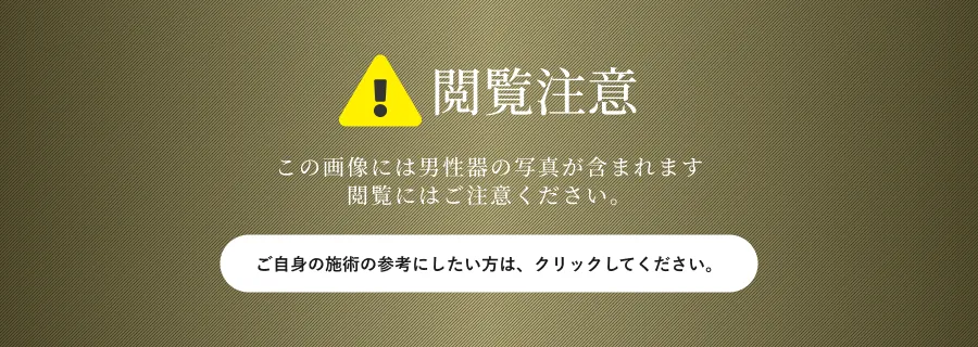 閲覧注意