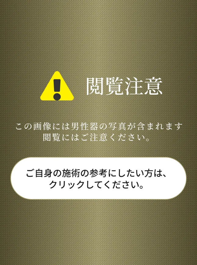 閲覧注意