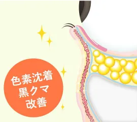「ふくらみだけでなく、皮膚再生効果により茶クマも改善」された状態のイラスト