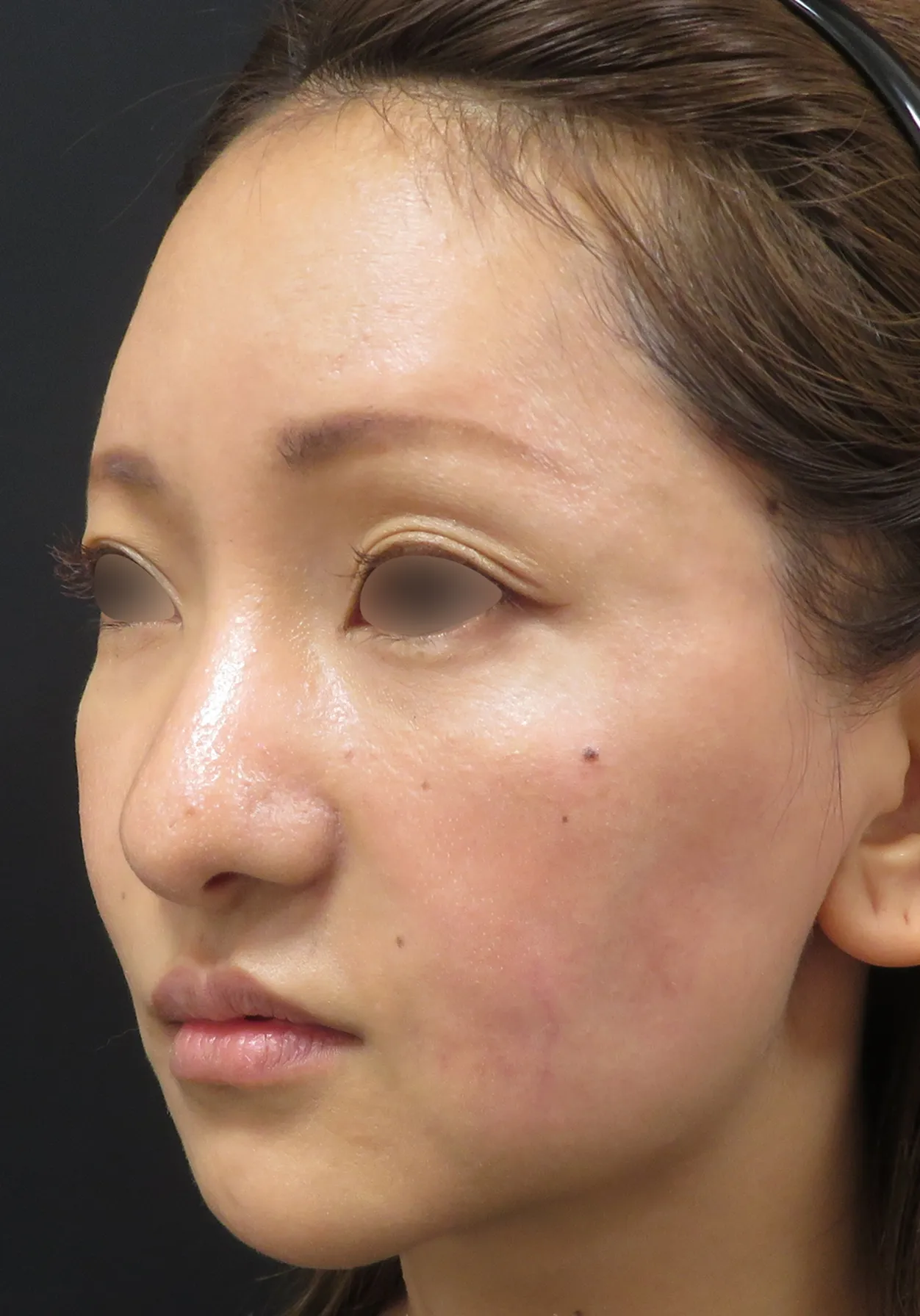 after:女性の顔