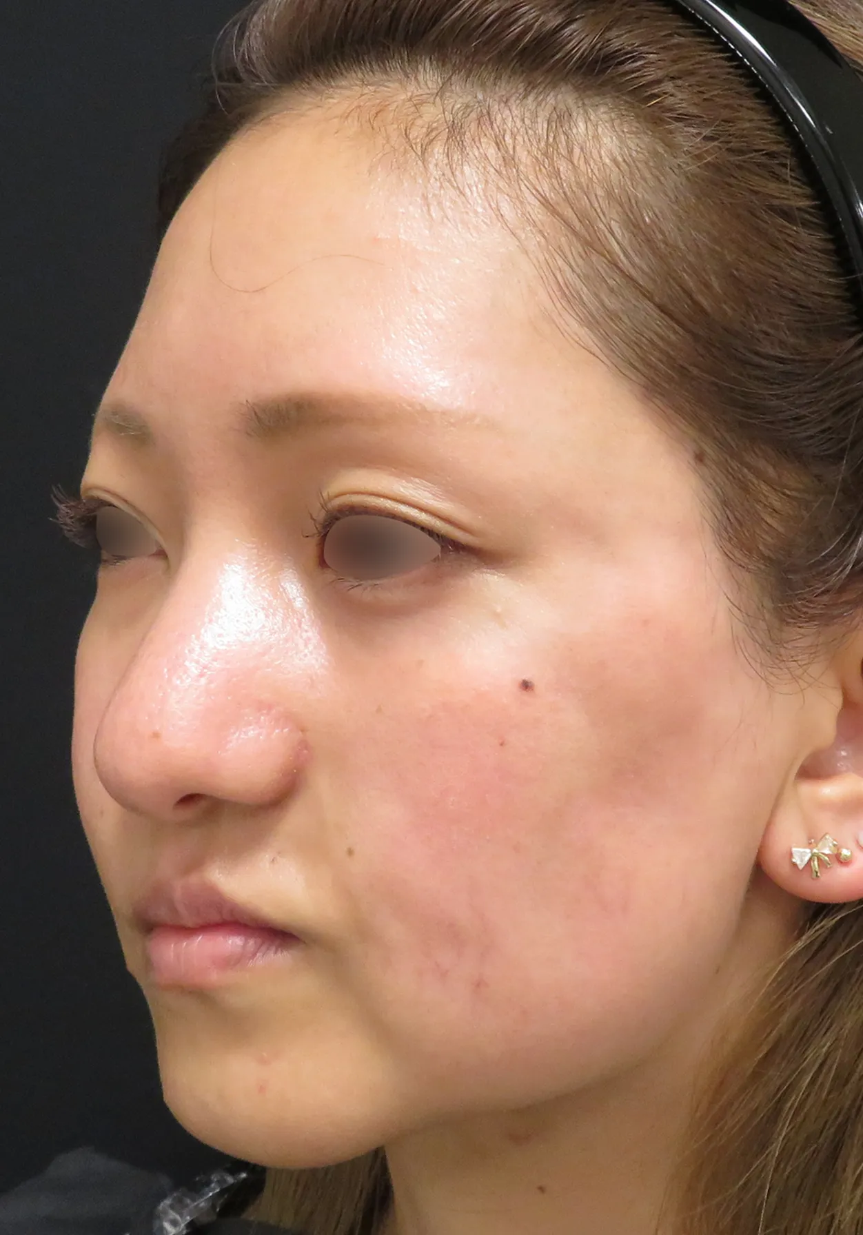 before:女性の顔