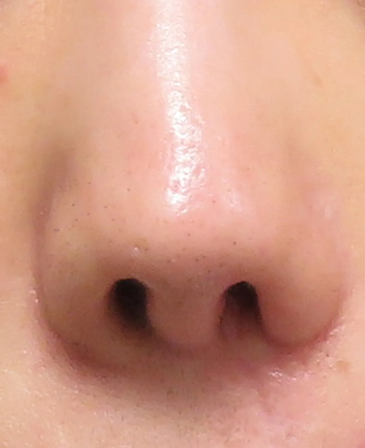 before:女性の鼻