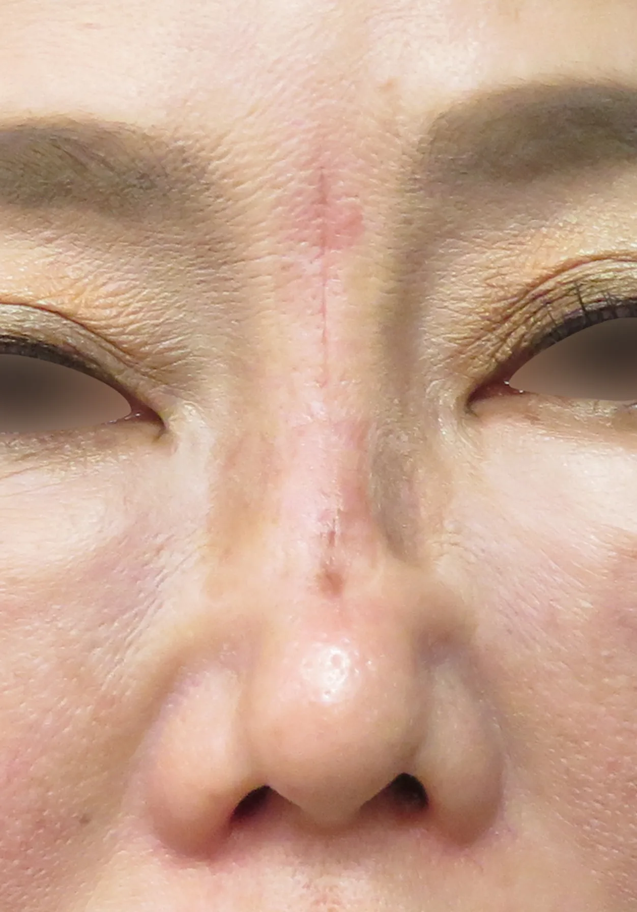 before:女性の顔