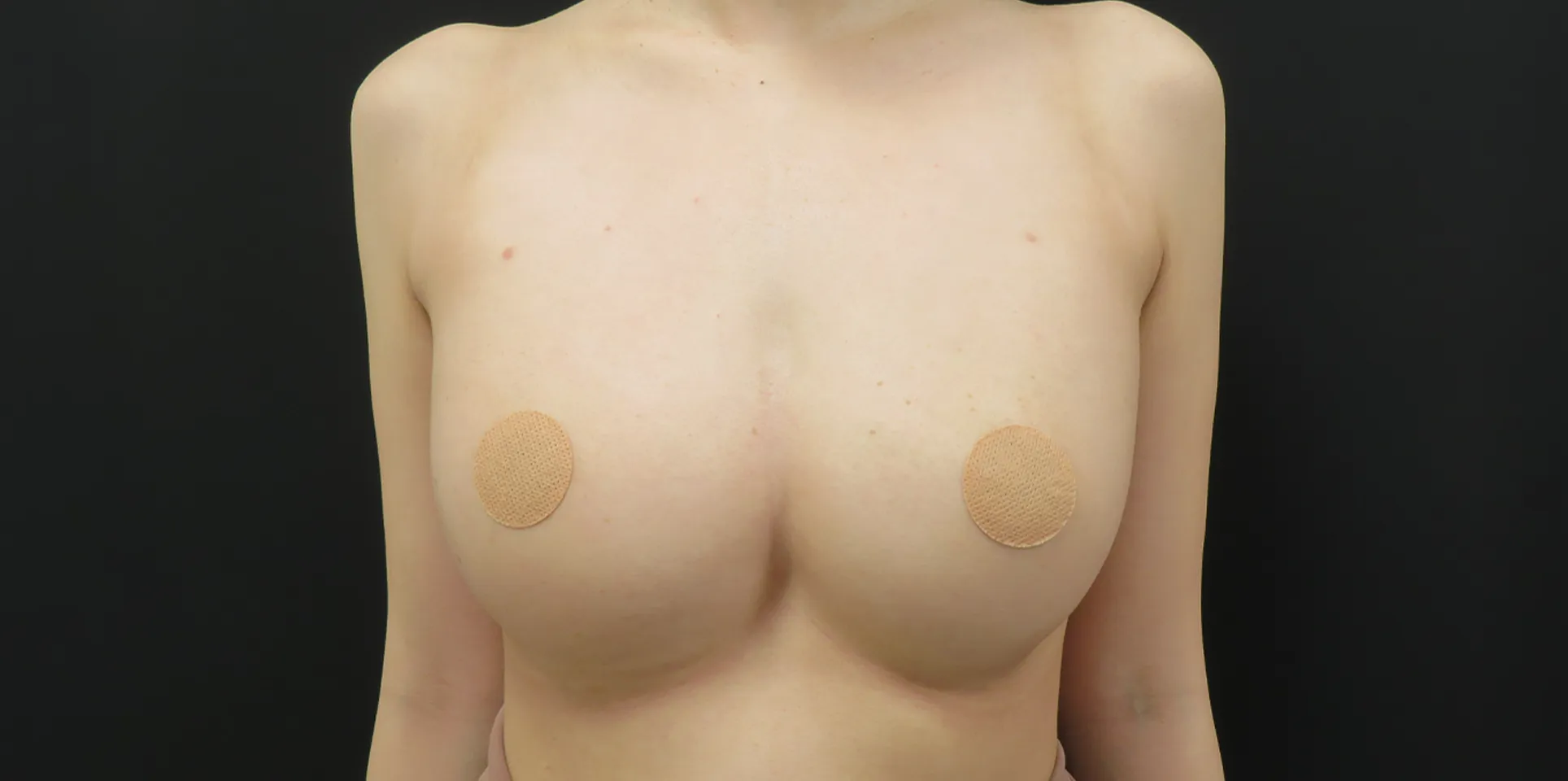 after:女性の胸