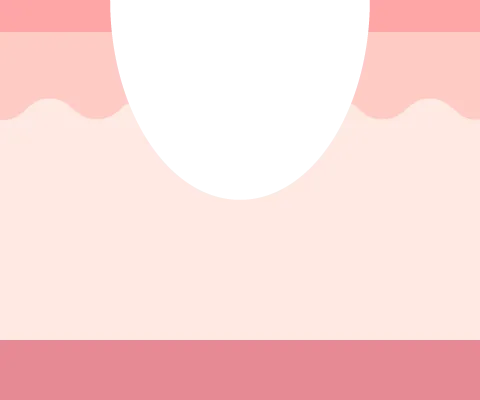 ローリング型